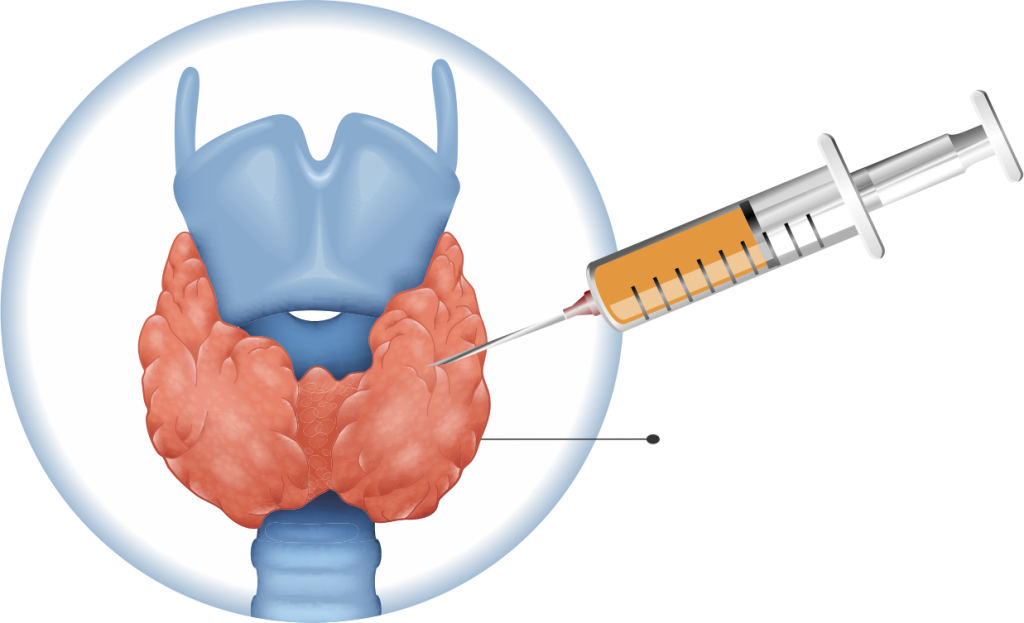 Como Funciona o Exame PAAF da tireoide? Clínica Viver