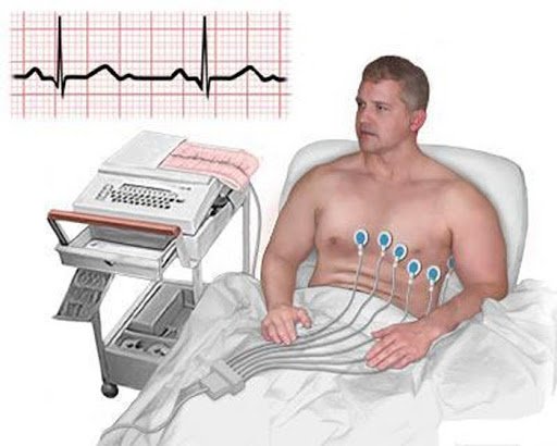 Ecocardiograma e eletrocardiograma: conheça as diferenças entre os exames